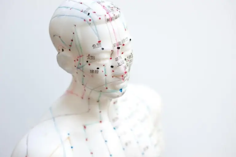 Acupuncturist voert behandeling uit in rustgevende praktijkomgeving voor acupuncturisten in Deventer